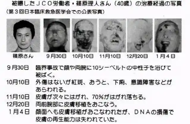 核辐射为啥那么恐怖?全身dna断裂的后果,可能超乎你的想象