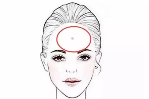 额头上方中间的痣好吗额头中间有痣命运如何