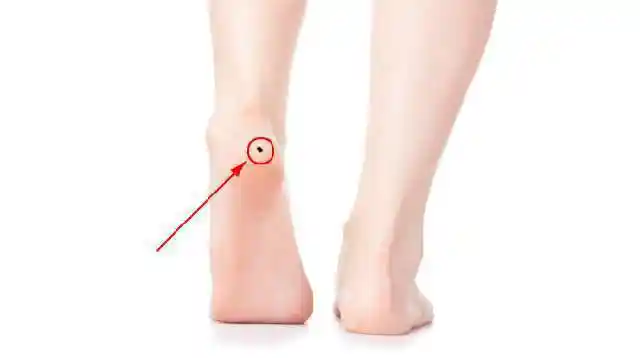 痣长在左腿膝盖的左侧,表面十分黯淡,此痣为多灾多难痣.