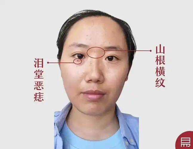 【真人看相】|面相|痘印|山根_网易订阅