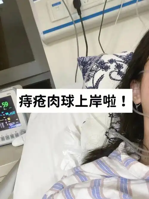 真的跪谢关于痔疮肉球要知道的事