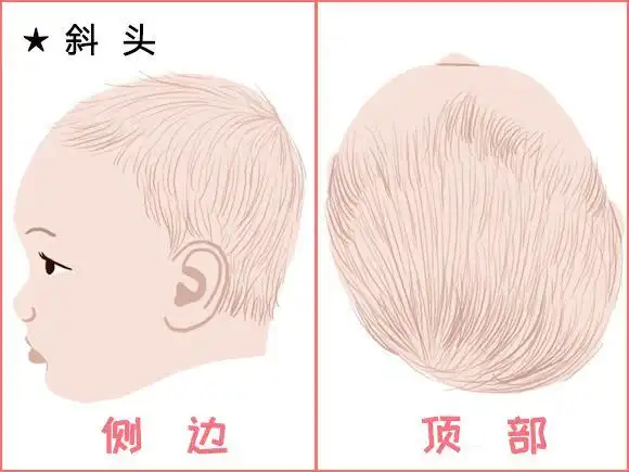 求放过不要再给孩子睡扁头了瞧瞧这些明星的后脑勺有多丑