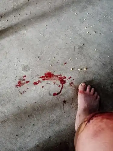 地上也被鲜血染红一大片啦