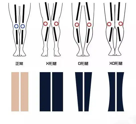 看腿型,选裤子!搞定各类"不完美"腿型