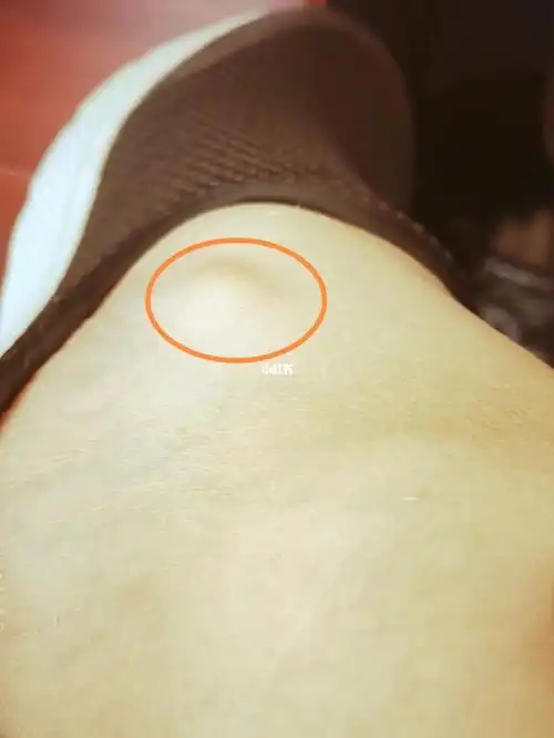 脚内侧这个地方比别人高出很多,摸着是骨头,知道的解答一下吧!