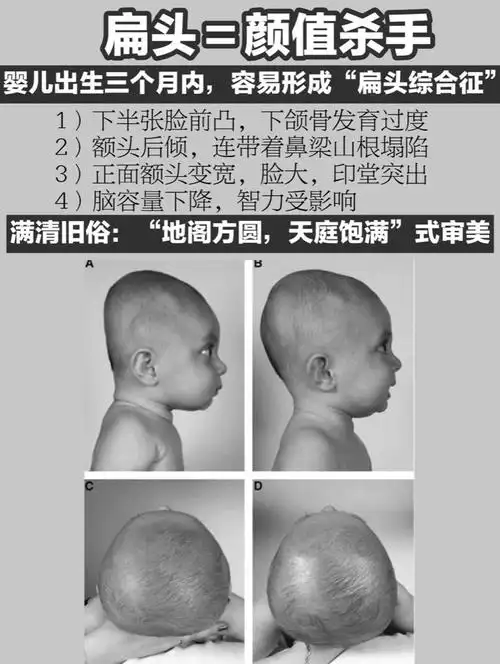 两个典型侧脸对比 刘诗诗(扁头): 后脑勺扁平,脸深度很浅,五官不立体