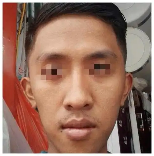 额头一旦有此"龙角骨"出现,此生必定富贵荣华,绝非凡人!__财经头条