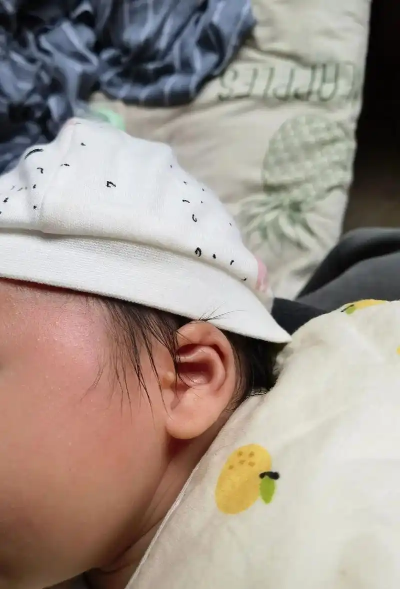 我家崽崽生下来,左边有一个附耳,两个耳朵在我肚子里压得有点变形