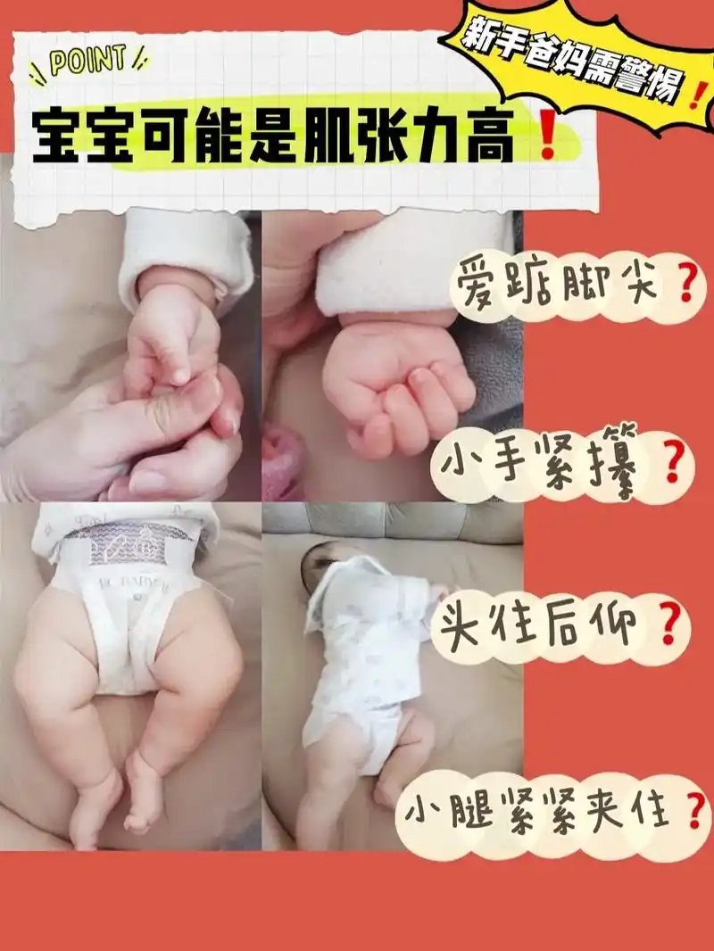 宝宝肌张力高是怎么回事呢71|#新手爸妈必看#育儿经验分享 # - 抖音