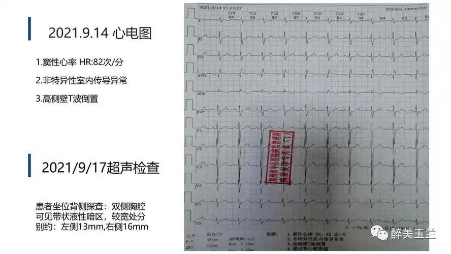 病例讨论妊娠合并复杂先心病剖宫产麻醉管理回看开放