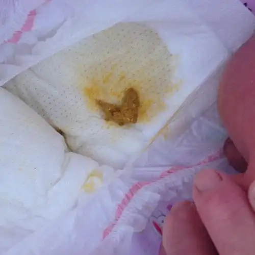 宝宝便便干的稀的分开怎么回事