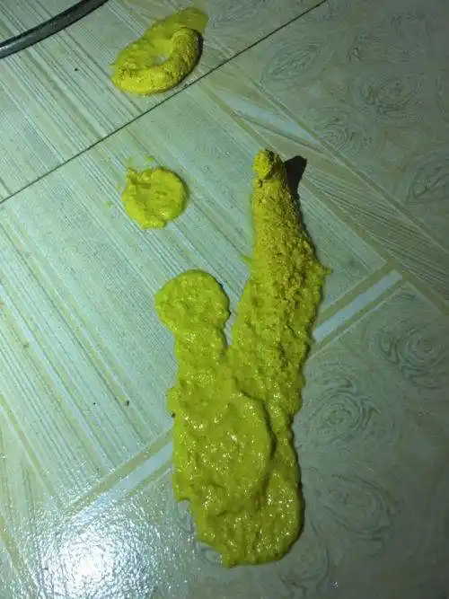 喝奶粉一直拉绿色大便 喝奶粉拉绿色大便怎么办