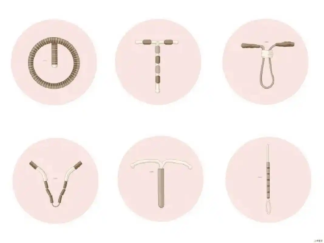 全世界的宫内节育器大约有30多种,按材料可分为惰性和活性两类.