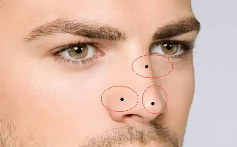 男人鼻子上有痣代表什么,一起来看看