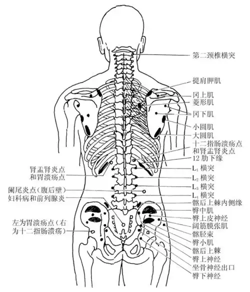 软组织损伤性腰痛和腰腿痛