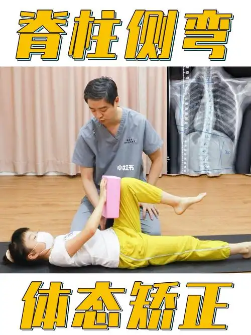 脊柱侧弯专项训练体态调整