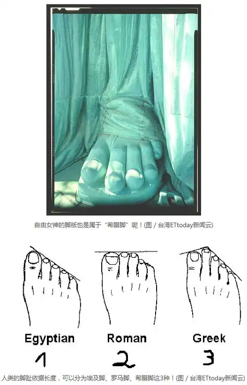 人类脚趾长度分三种希腊脚专出美女