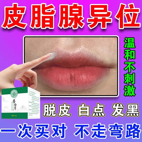 新品 皮脂腺异位症嘴唇白点私处小丘疹疱诊旺盛干裂脱 单盒(体验装)