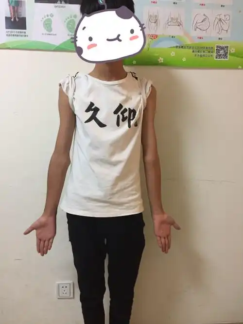 病例分享 | 肘内翻 - 好大夫在线