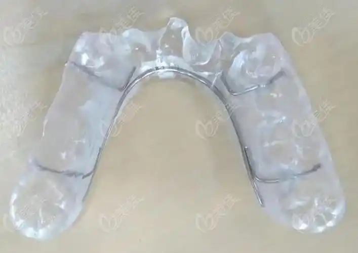 深覆合平导和颌垫哪种好那正畸中颌垫和平导的区别要晓得