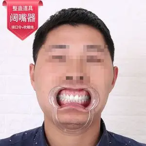 抖音同款开口器结婚一次性c型开口器扩嘴器张口器整蛊游戏扩口器