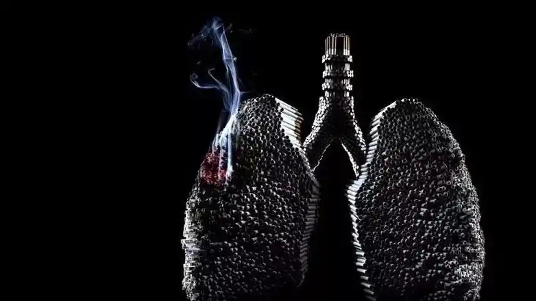 吸烟,随着年龄的增长尤其是四十以后,肺部也是会出现变黑现象这是一种