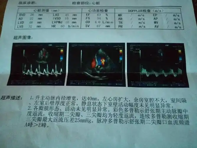 升主动脉内径增宽40mm左心房扩大,主动脉瓣中度返流,二尖瓣中度返流,