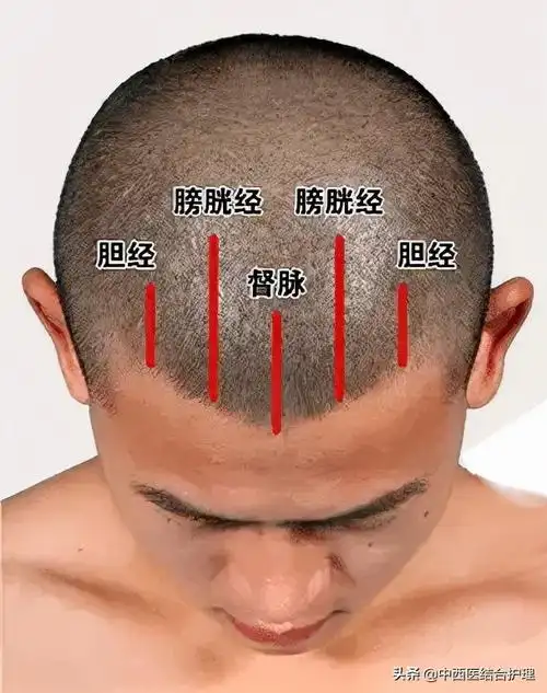 手法:右手五指分别置于头部督脉,膀胱经及胆经上,自前发际推至后发际5