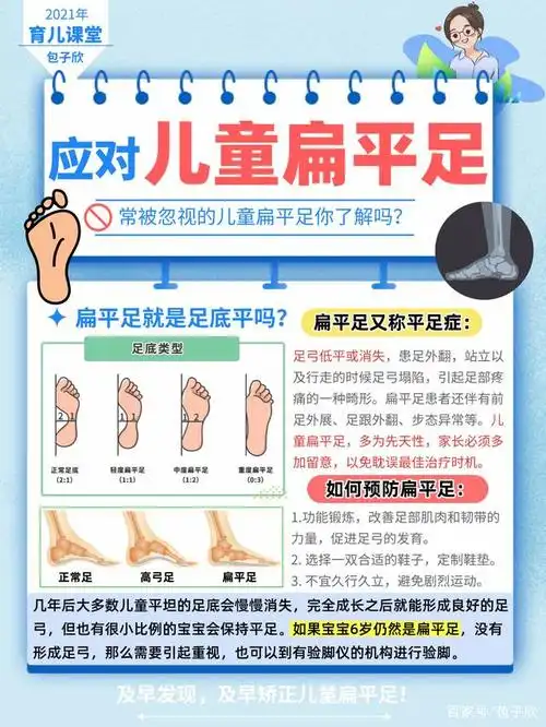 宝宝扁平足怎么矫正
