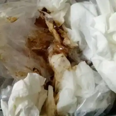 最近都还好主要是乾呕,今天突然吐的很厉害,吐了很多褐色东西出来,是