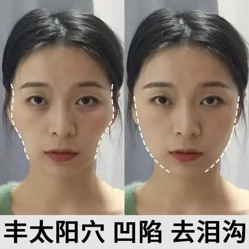 薇娅推荐告别泪沟神器不要凹陷丰盈精华液全脸液态精华