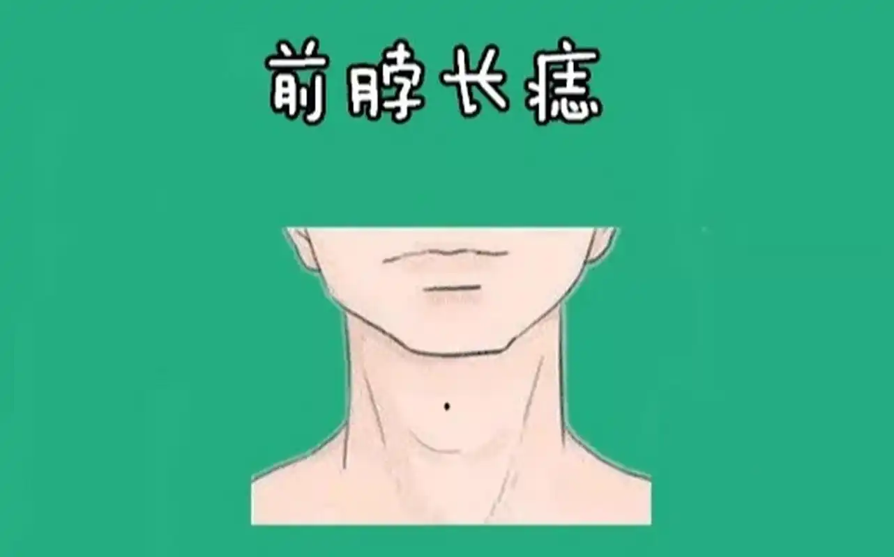前脖长痣 我们都知道长在脖子处的痣属于靠山痣,但若是痣长在前脖的