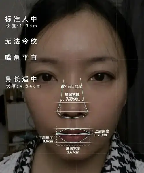 知识科普凹面型侧脸应该如何改善