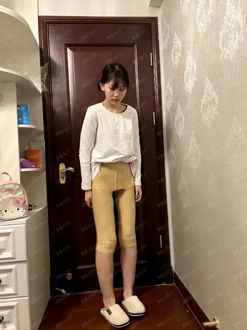 我主要是觉得大腿的根部有肉,穿裤子不好看,所以就做了吸脂.