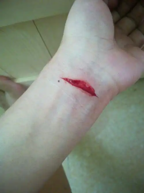 方式都删掉,不要再关注她,不去触碰那些记忆,乐观的去接受别的女孩,久