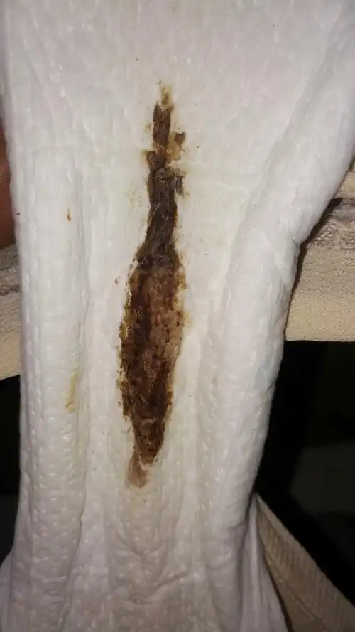 孕医通!先兆流产血的颜色三种"智能管理"-第2张图片-立途网