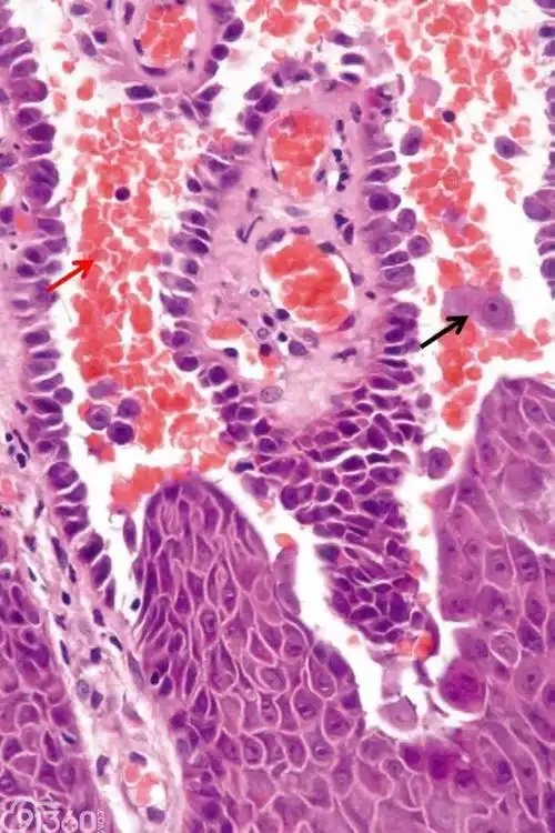 多图辨认组织病理中的细胞形态一