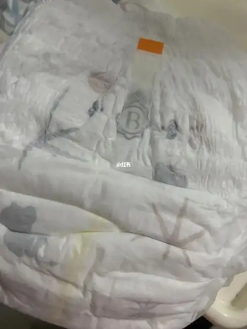 babycare拉拉裤皇室星星 急性过敏