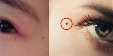 四种桃花劫痣相长在哪里