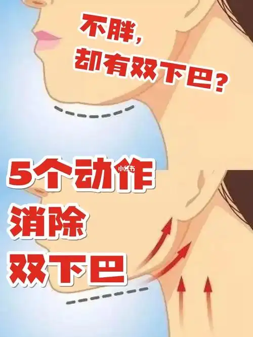 5个动作消除双下巴