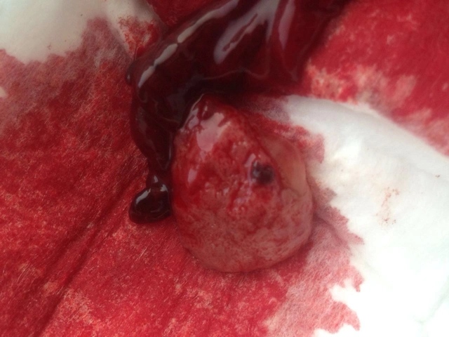 有做过药物流产的宝妈吗?