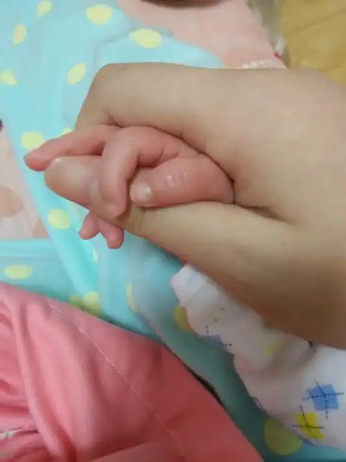 宝宝指甲根部发黑