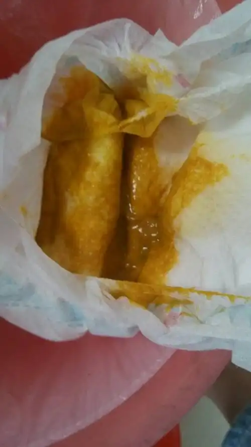 臭臭图!这样的臭臭正常吗?今天早上刚拉的,现在又拉了一次?