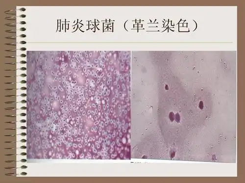 医学微生物学课件,你懂得 肺炎球菌(革兰染色)