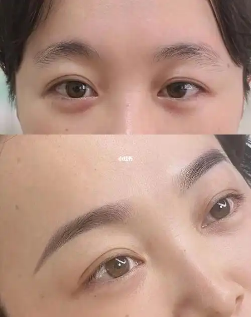 纹眉前后对比图