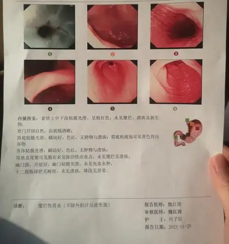 18岁 做完无痛胃镜结果出来了