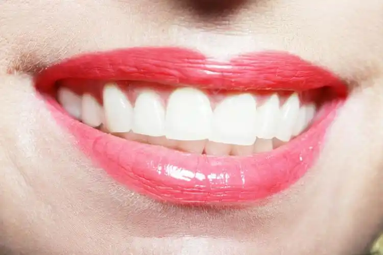 冷光美白对牙齿有用吗