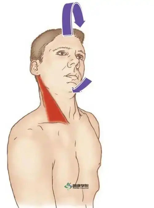 头面部疼痛关键肌——胸锁乳突肌