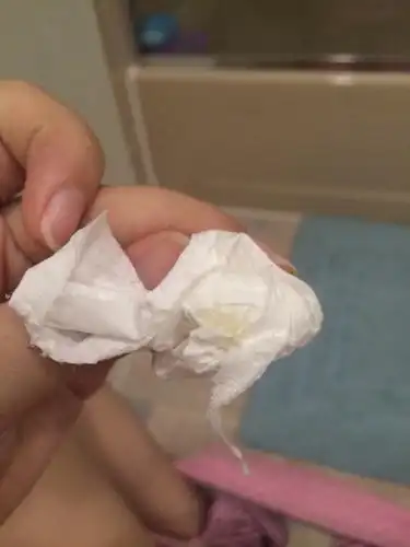 求大神!!!!我还在青春期16岁,平时就月经不准.这次月经推迟了,一直觉