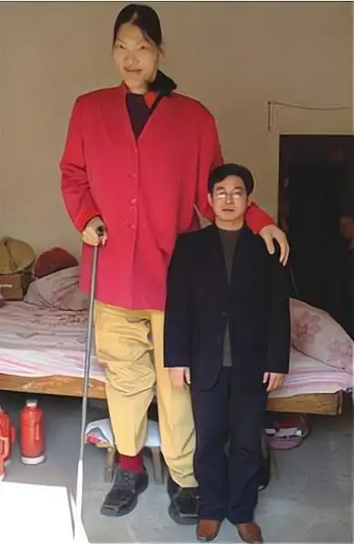 中国第一女巨人,身高2.48米,比姚明都高22厘米,年仅18岁离世